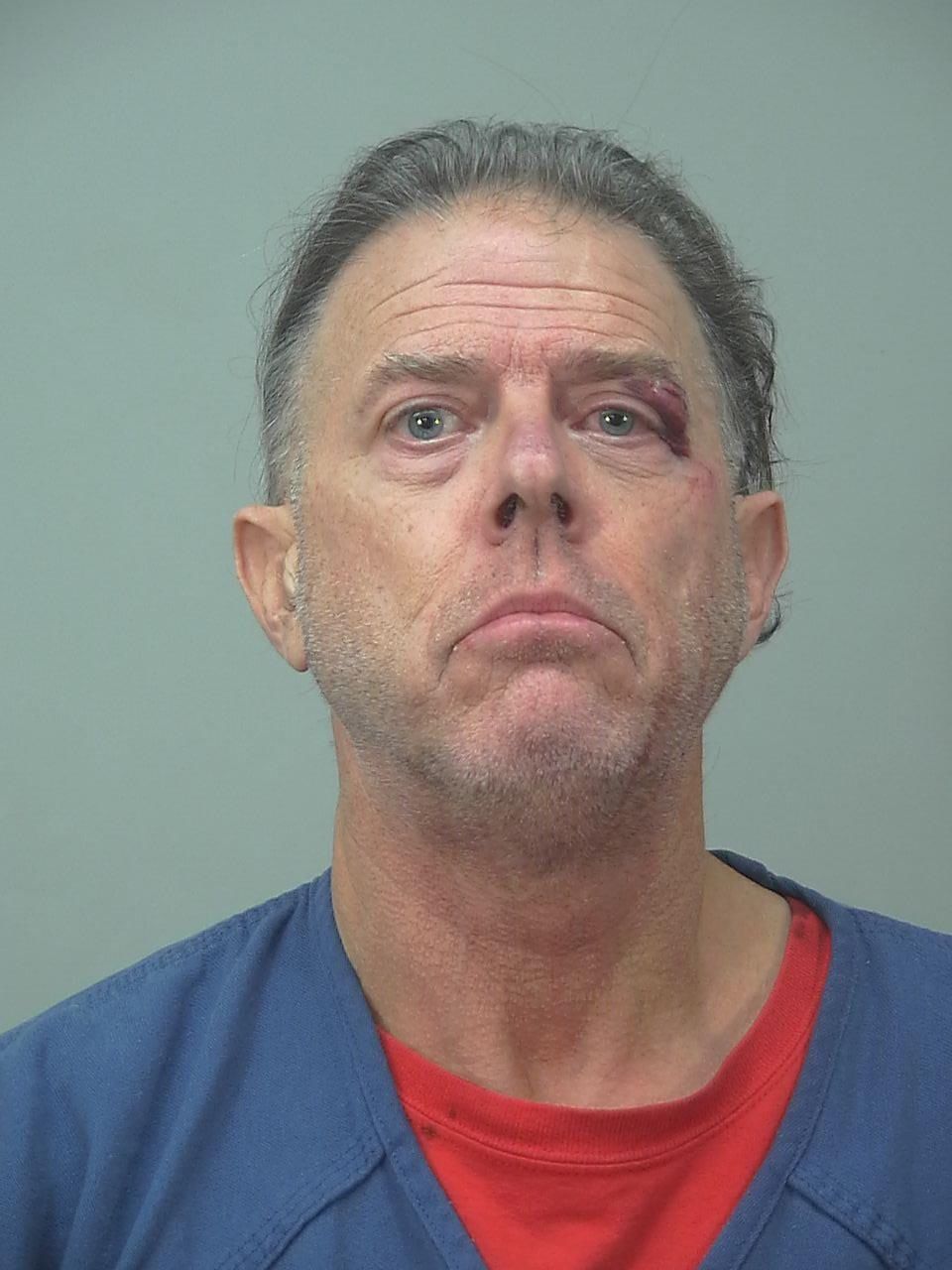 Cottage Grove man arrested after 'aggressive altercation' in UW Hospital parking ramp, police say
